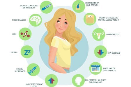 Female Infertility Image